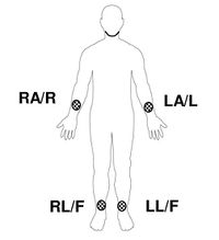 Limb Lead Placement