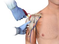 Humeral insertion.jpg